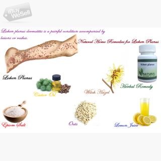 Natural Herbal Remedy for Lichen PlCensored